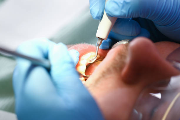 Best Emergency Root Canal Treatment in Grosse Pointe Park, MI