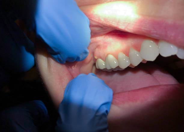 Best Pediatric Emergency Dentist in Grosse Pointe Park, MI